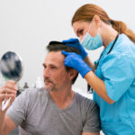 Hair Transplants